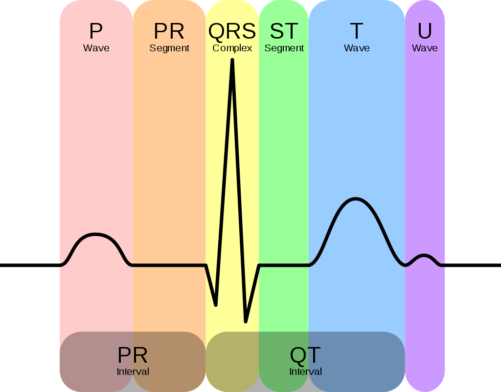 ECG